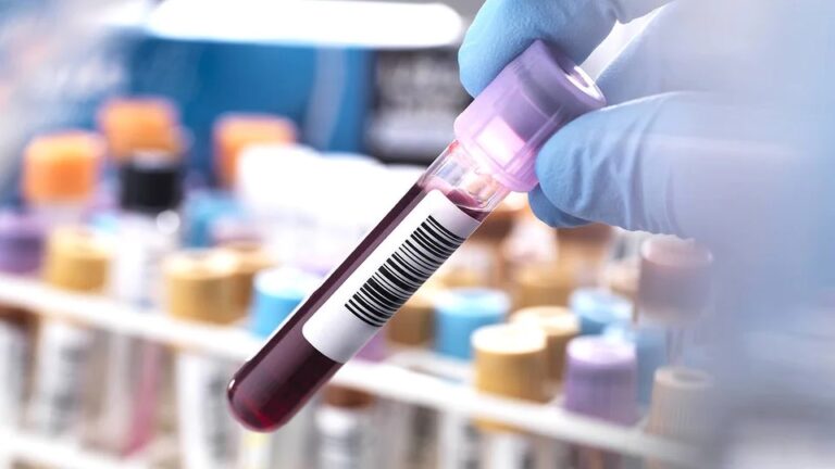 Demenz im Blut aufspüren