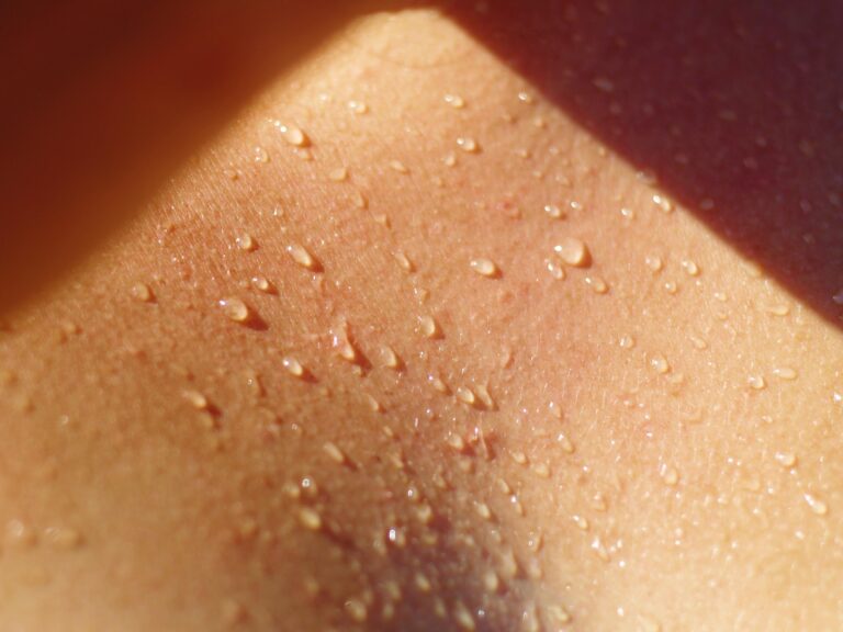 Sommer, Sonne – und Schweiss